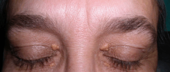 4 Facial Clues That May Uncover Hidden Health Concerns