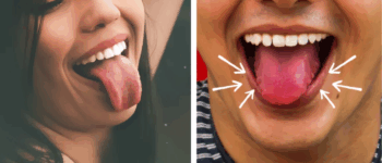 10 Symptoms That Could Indicate Health Issues